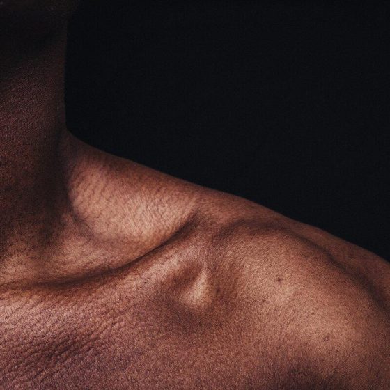 15 frozen shoulder da3e13d9