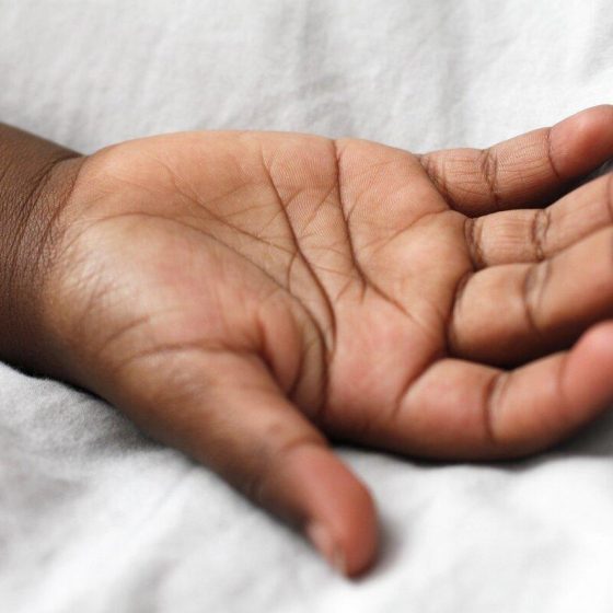 13 trockene haende acab4d0b