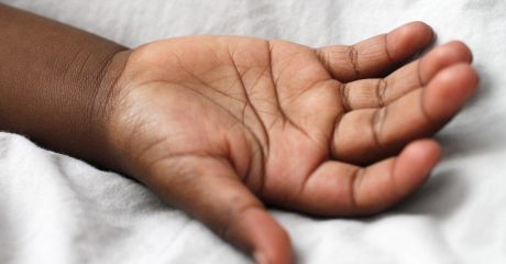 13 trockene haende acab4d0b