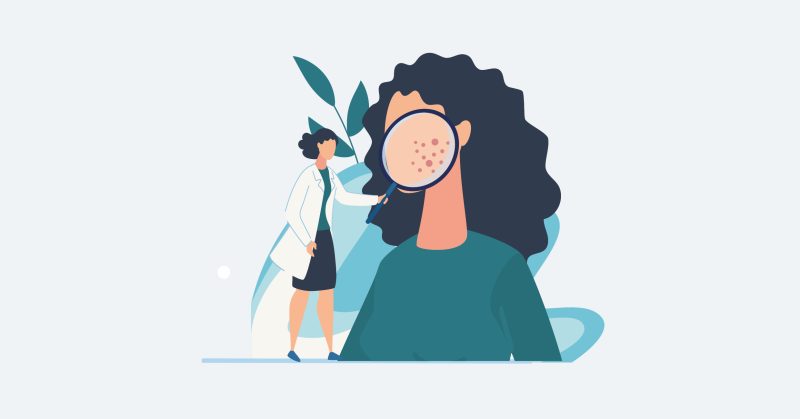 Man sieht eine illustrierte Frau die mit einer riesen Lupe auf ein Frauengesicht hält, damit man die Sporen einer Haut erkennen kann.